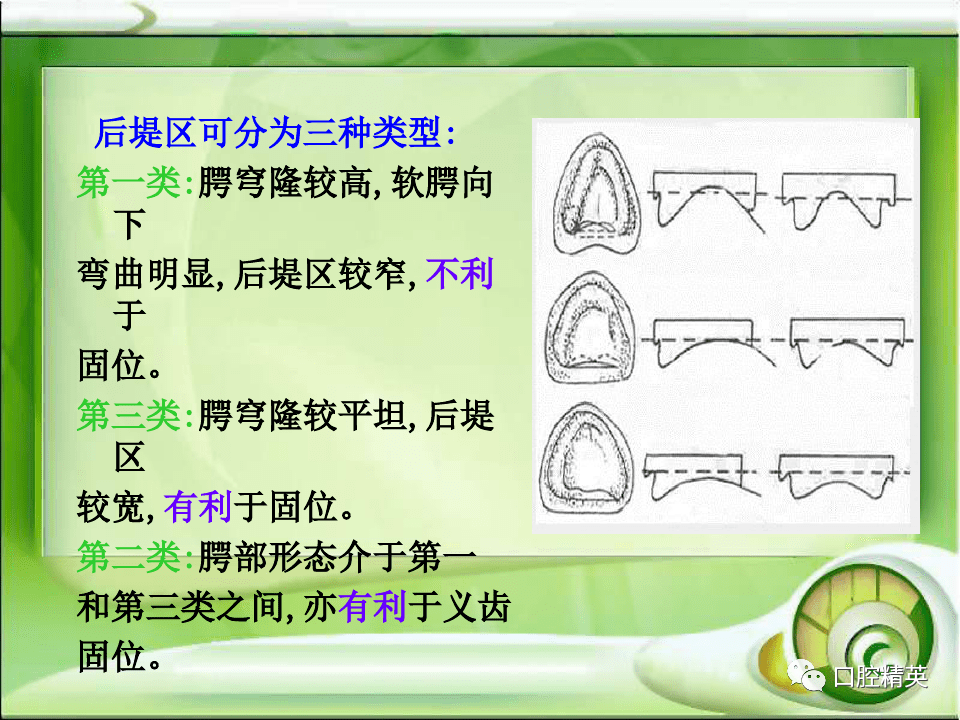 全口无牙颌解剖标志识别