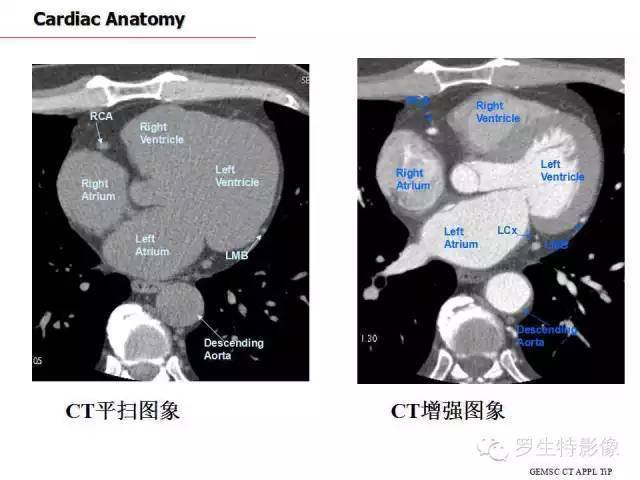 收藏史上最全的ct断层解剖图谱一篇所有都有