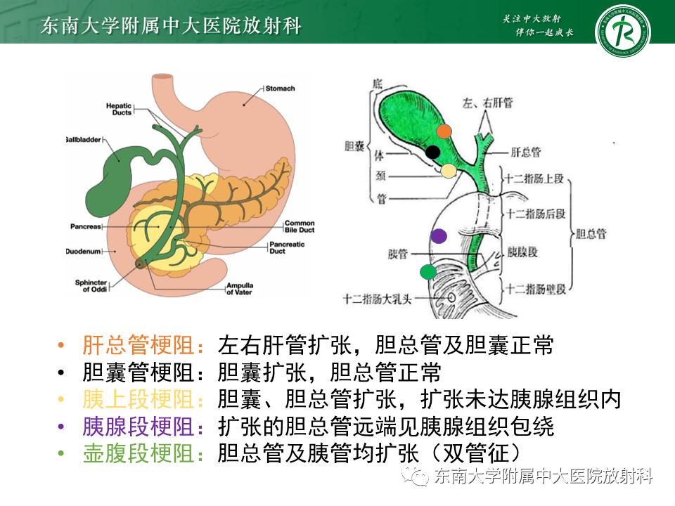 晨读结果公布20210207消化系统疾病胆囊癌