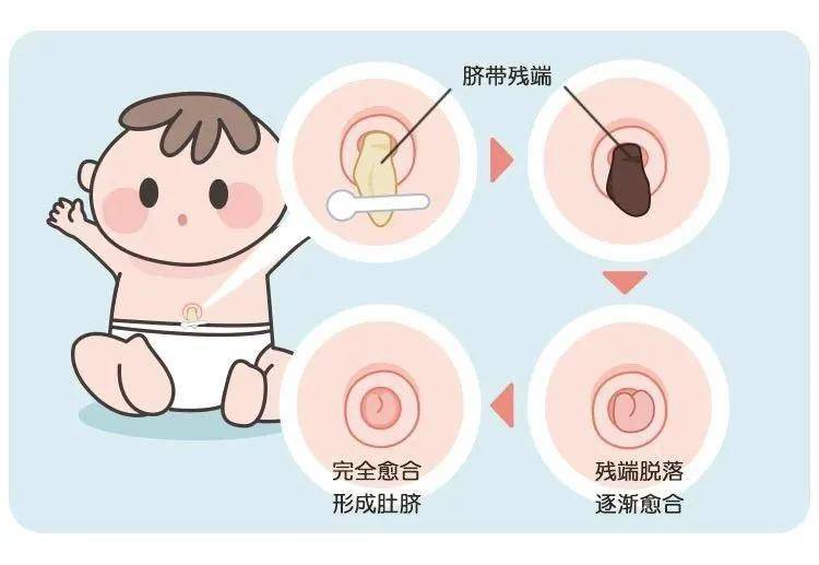 小肚脐也有大学问?新手妈妈用得上