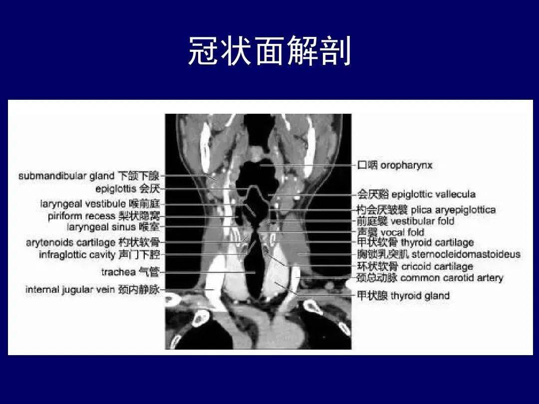 收藏史上最全的ct断层解剖图谱一篇所有都有