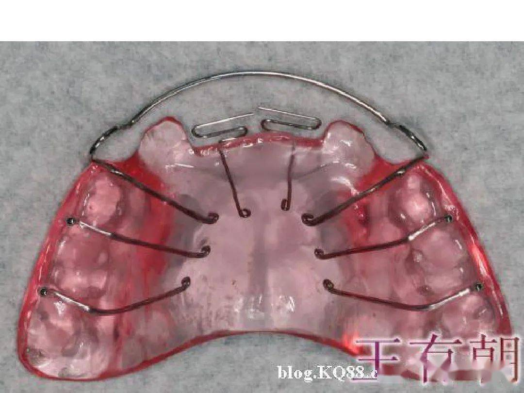 正畸活动矫治器图谱