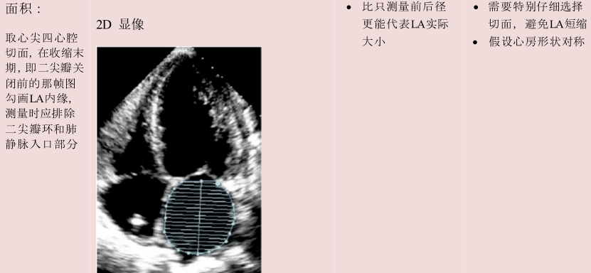 【干货分享 ● 上集】 成人超声心动图心腔测量细节与