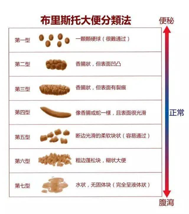 绿便奶瓣泡沫水便分离警惕便便中暗藏的疾病信号