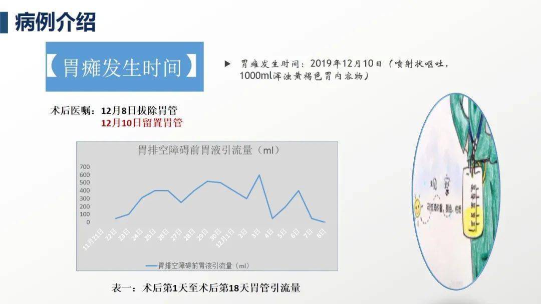 ppt一例胃排空障碍病人的护理查房