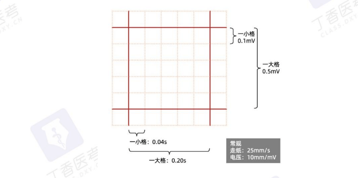 心电图会描记在特殊的心电图记录纸上,该纸由纵,横虚线划分成1mm的小