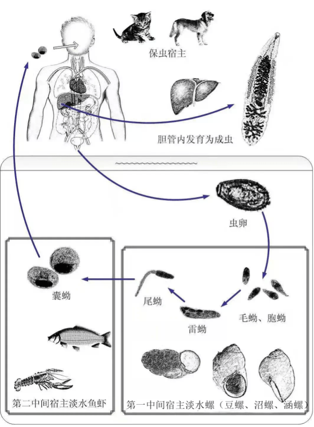 感染肝吸虫后,是否发病及严重程度,取决于寄生在胆管中的成虫数量,轻