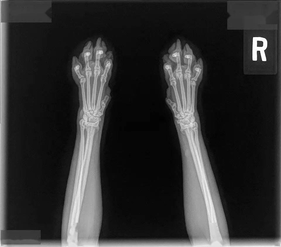 但可以明确的是,猫咪骨骼发育完全时,爪爪的x光片绝对就长这样