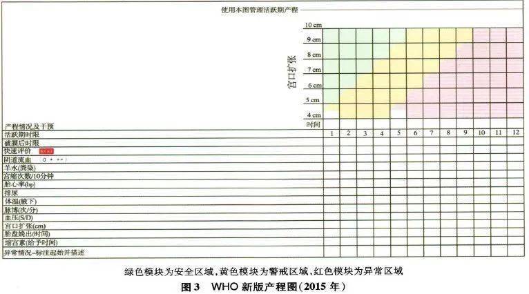 新产程标准下,是否还需要绘制产程图?