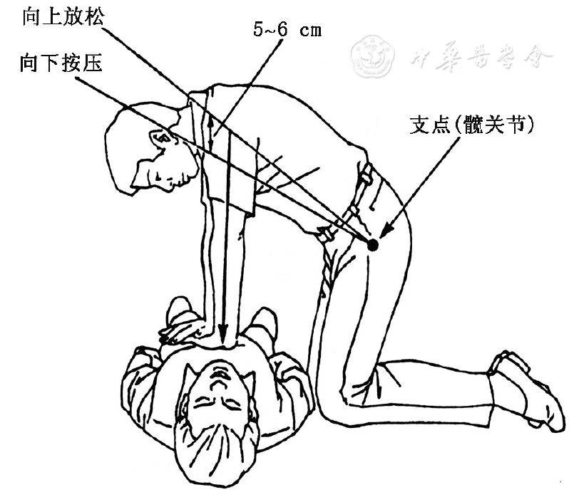 心肺复苏示意图