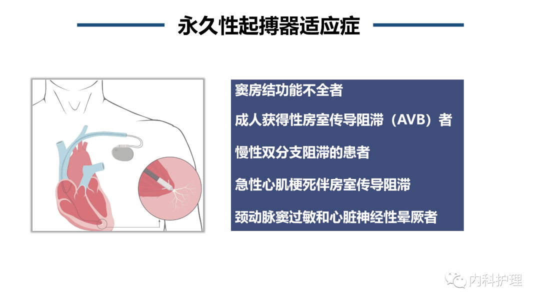 心脏永久起搏器植入术后的护理