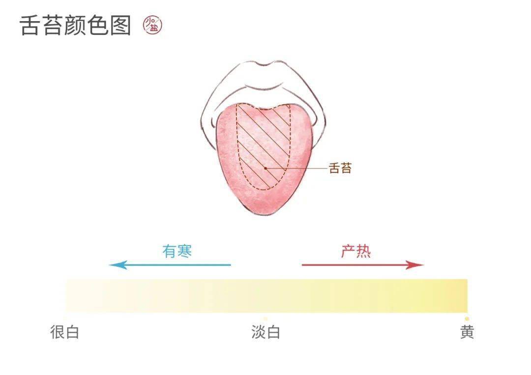 舌苔如果变黄,说明外邪已经侵入到身体内部,淤积的越来越多,开始产热