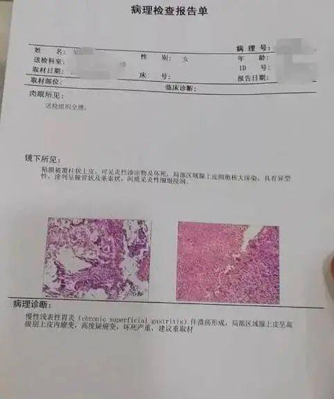 29岁二胎宝妈胃癌去世提醒4类人早做胃镜根除幽门螺杆菌