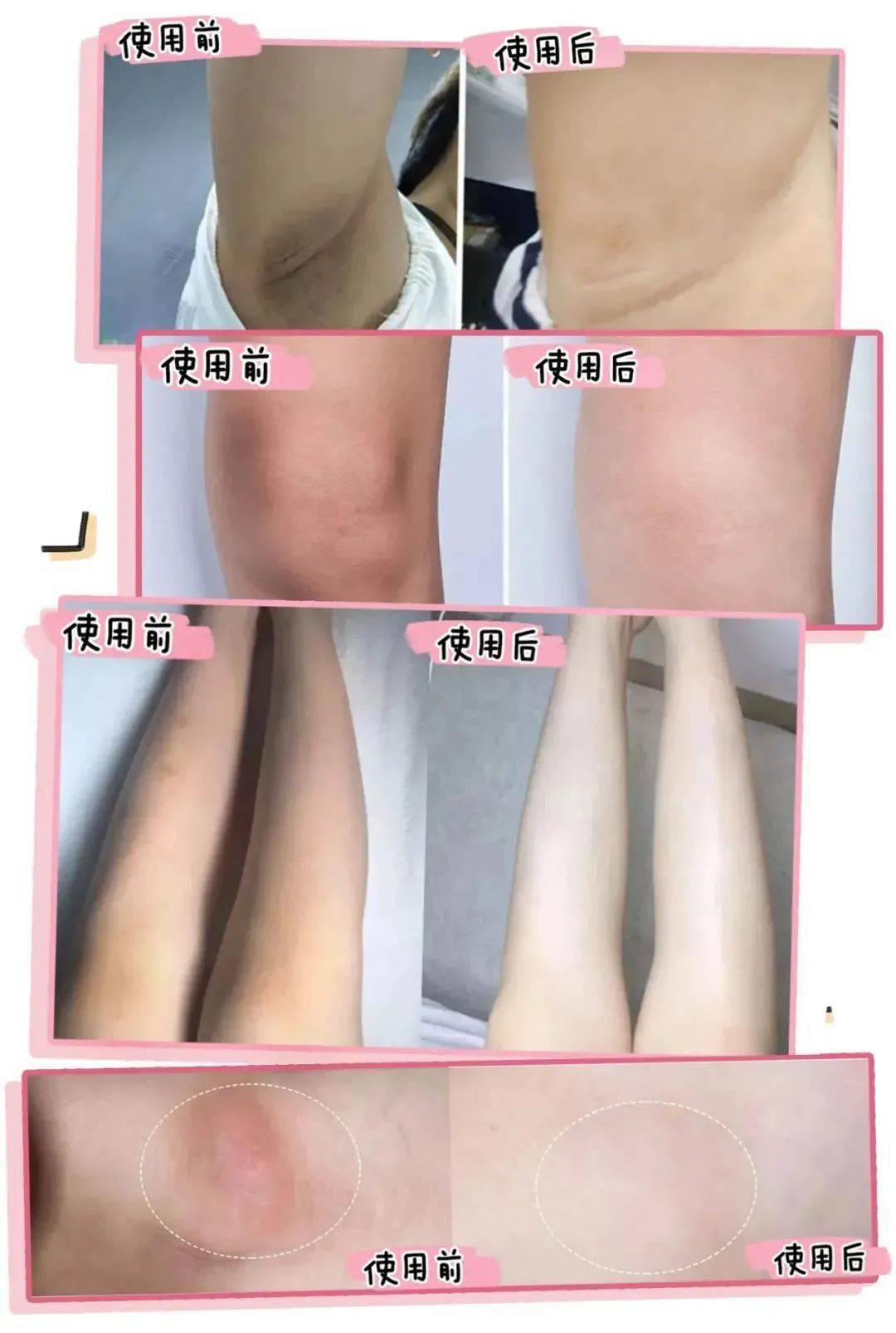 比"蹭蹭不怀孕"更恶劣的谎言,99%的女生在"papa"时被骗过!