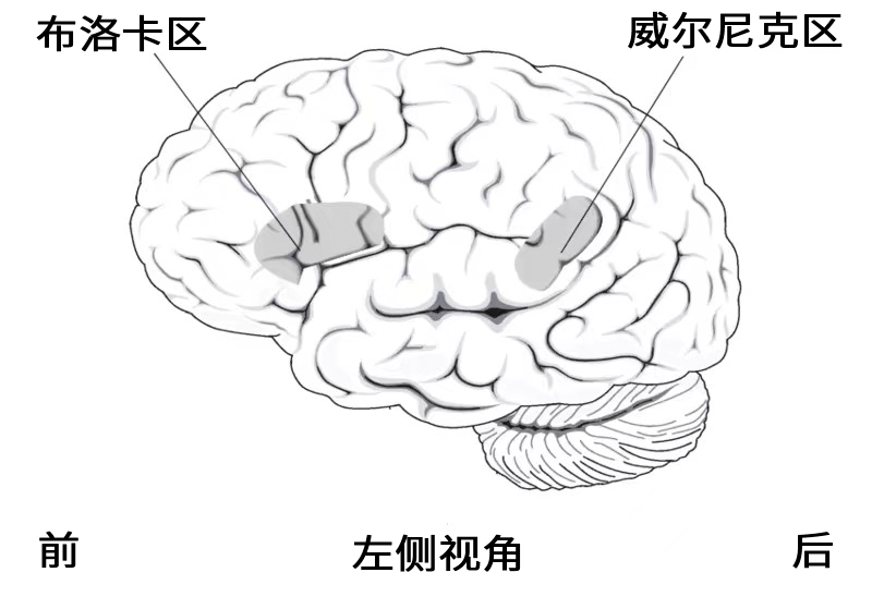 而大脑的另一个区域,威尔尼克区(ba22,该区域受损,患者能听到别人