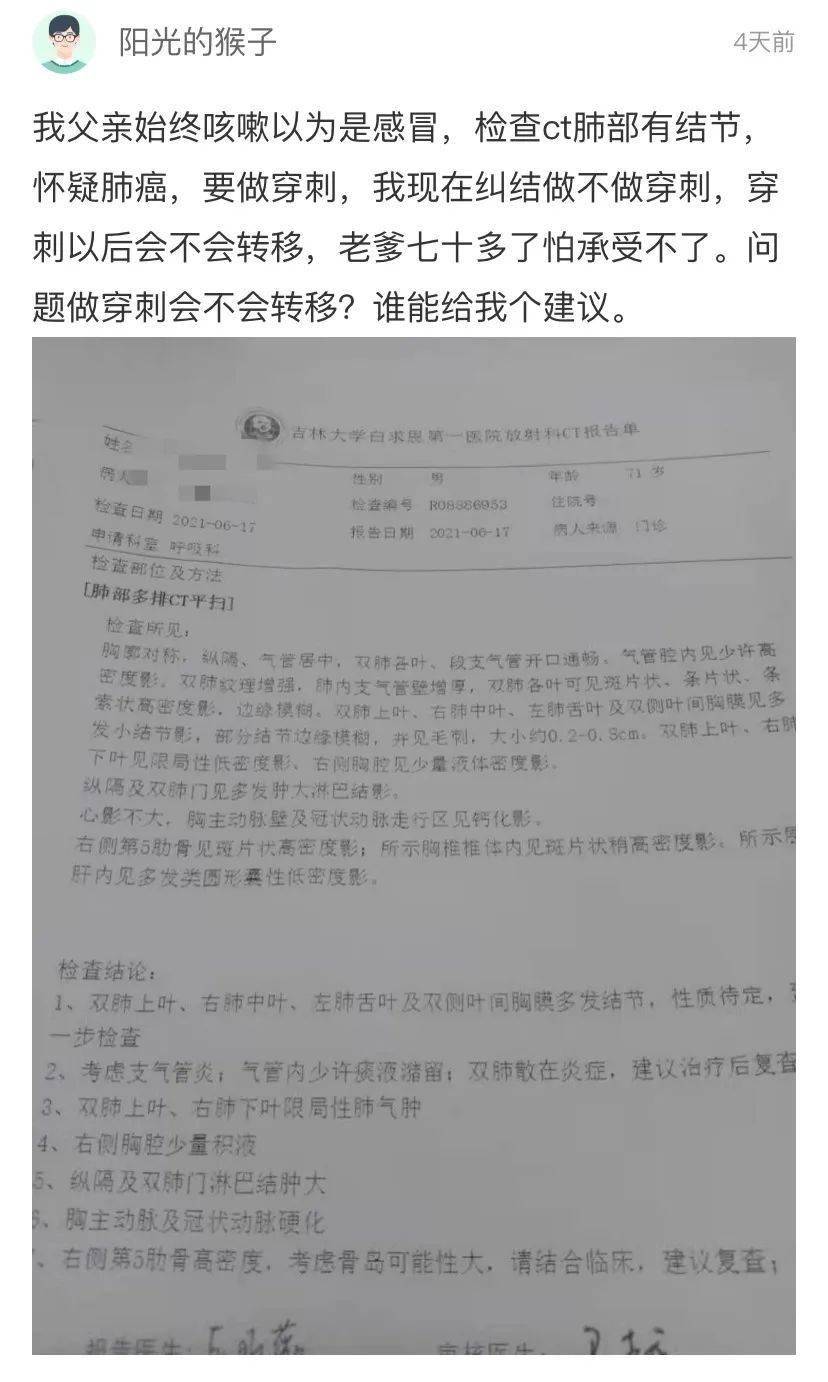 觅健互助 | ct检查肺部有结节,怀疑肺癌要做穿刺,做穿刺会不会转移?