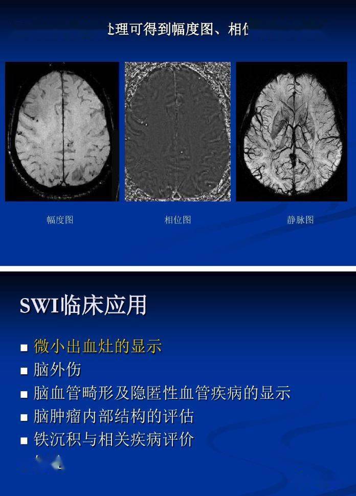 磁敏感加权成像(swi)详细临床应用