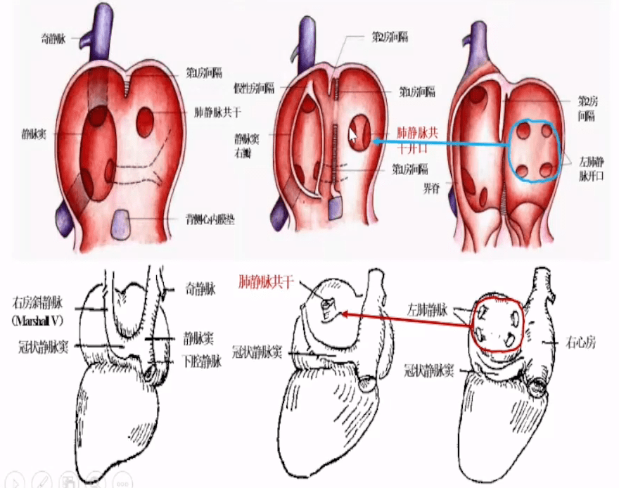 图1. 左房后壁与肺静脉的结构特征