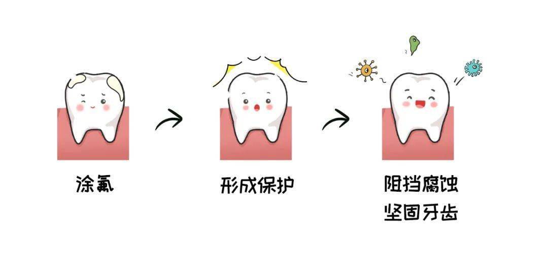 涂氟防龋其实就是给牙齿穿上防护衣.