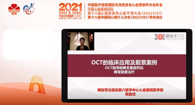 致清影像精准在沃沃福曼医疗蓝帆医疗国产oct研发与应用专题会圆满