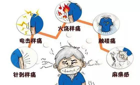 带状疱疹的痛苦