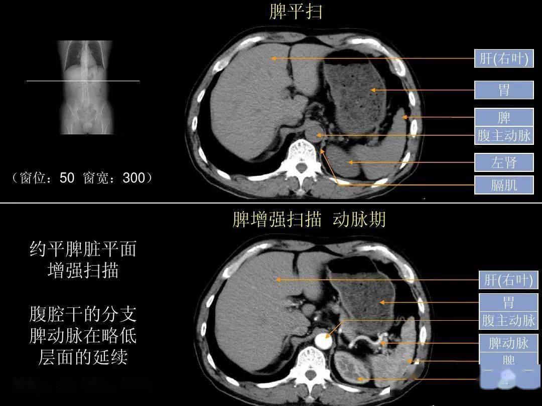 超细的腹部ct应用入门必备手册(原理 精美解剖图谱)