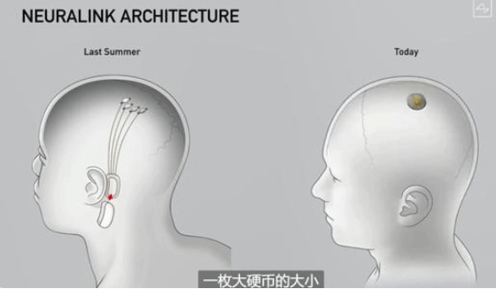 所想即所得—脑机接口发展前景:跨维沟通或成现实?