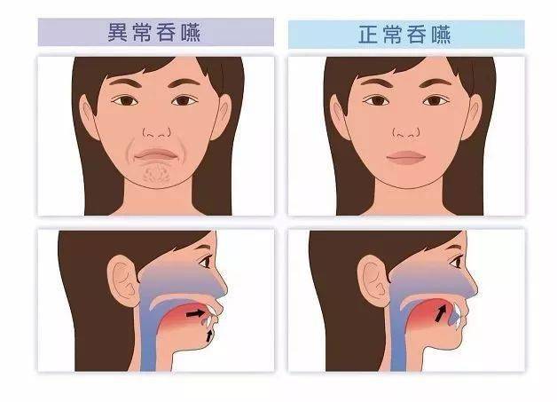 每天坚持做这4个动作,可瘦脸,还能赶走松弛_舌头