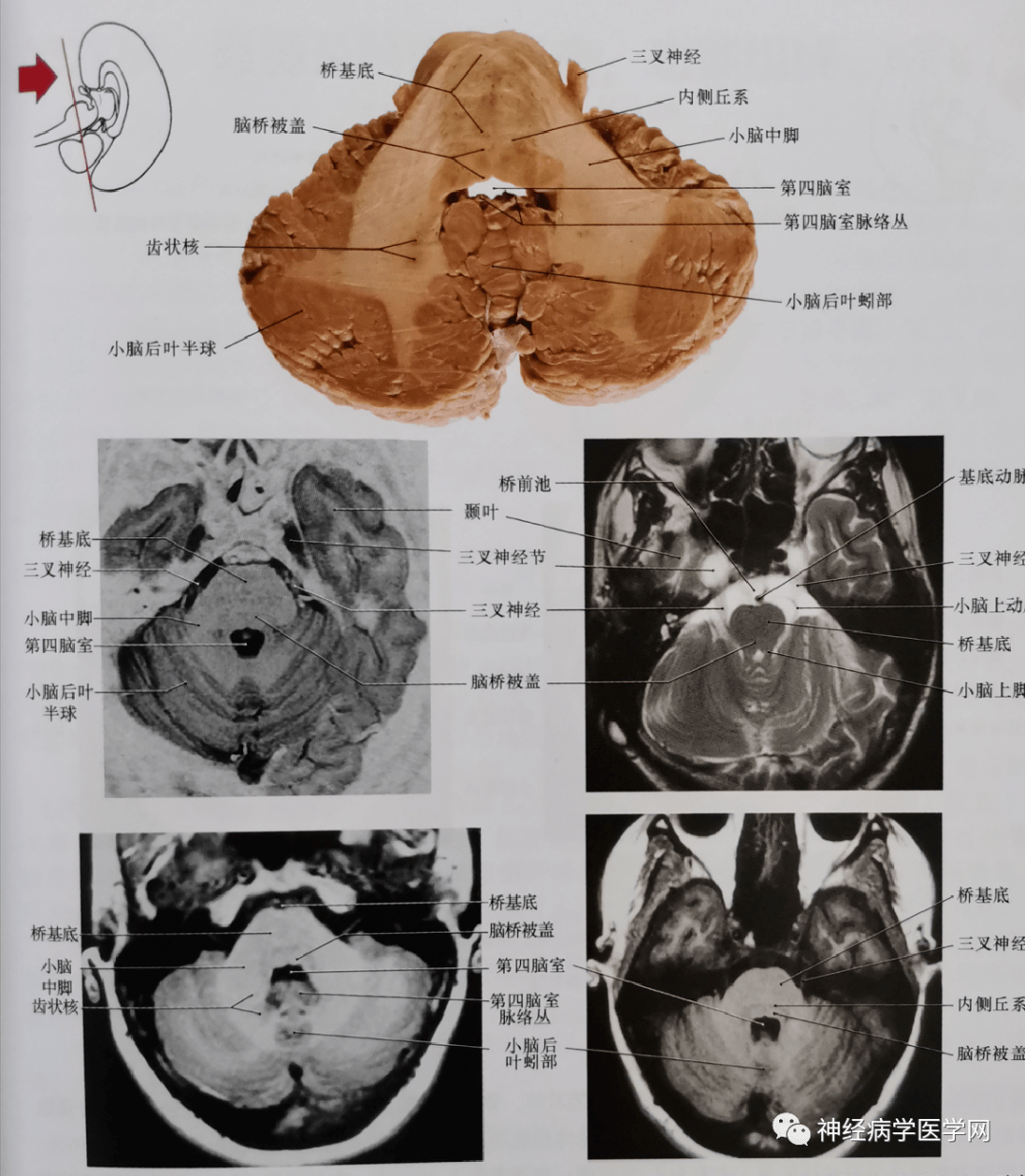 临床神经解剖图谱断层影像切片