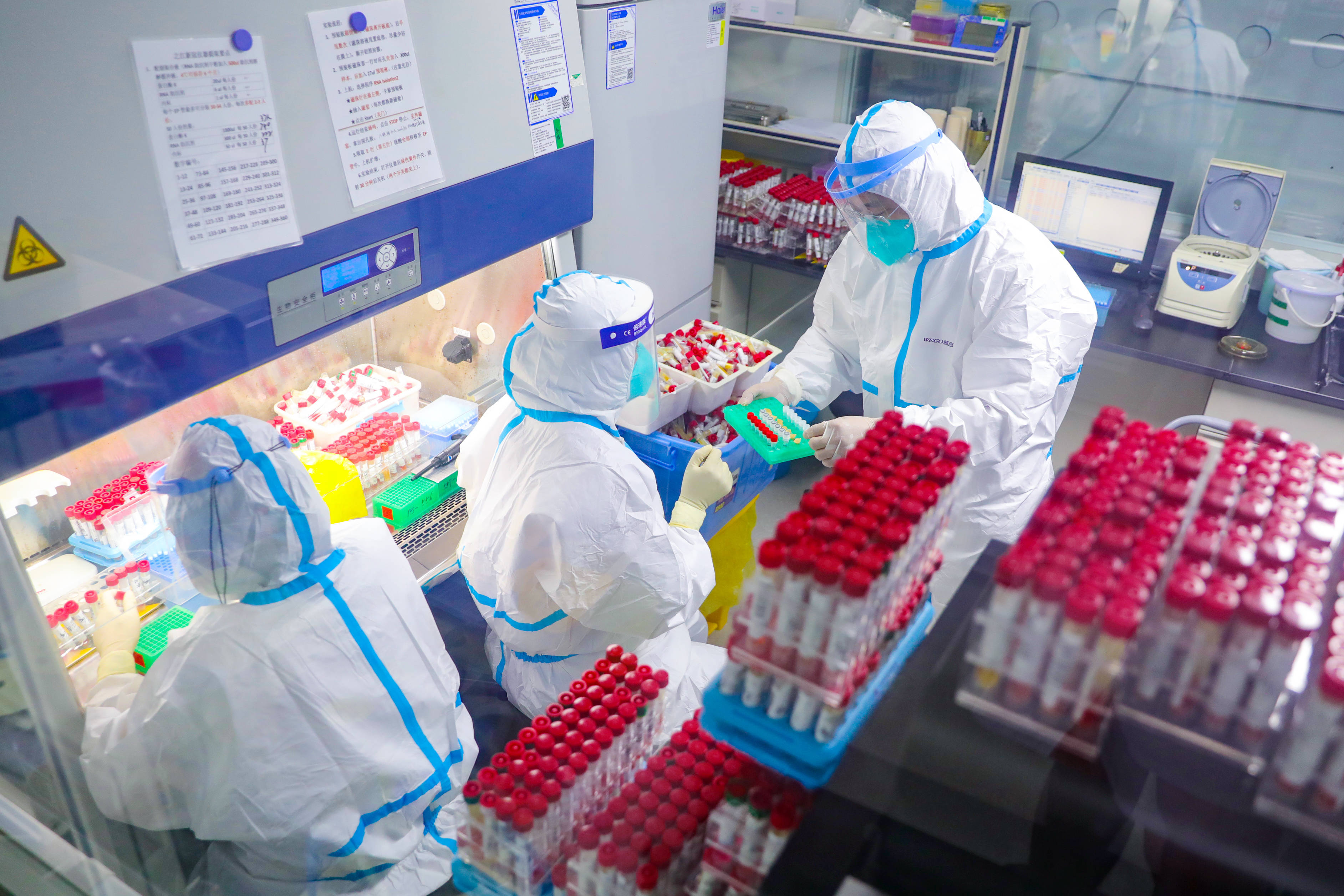 探访烟台毓璜顶医院核酸检测实验室一个动作一天重复8000次