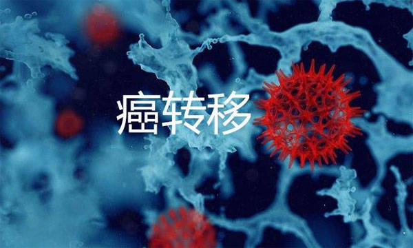 肺癌复发转移也能预测?出现这8个症状一定要警惕!