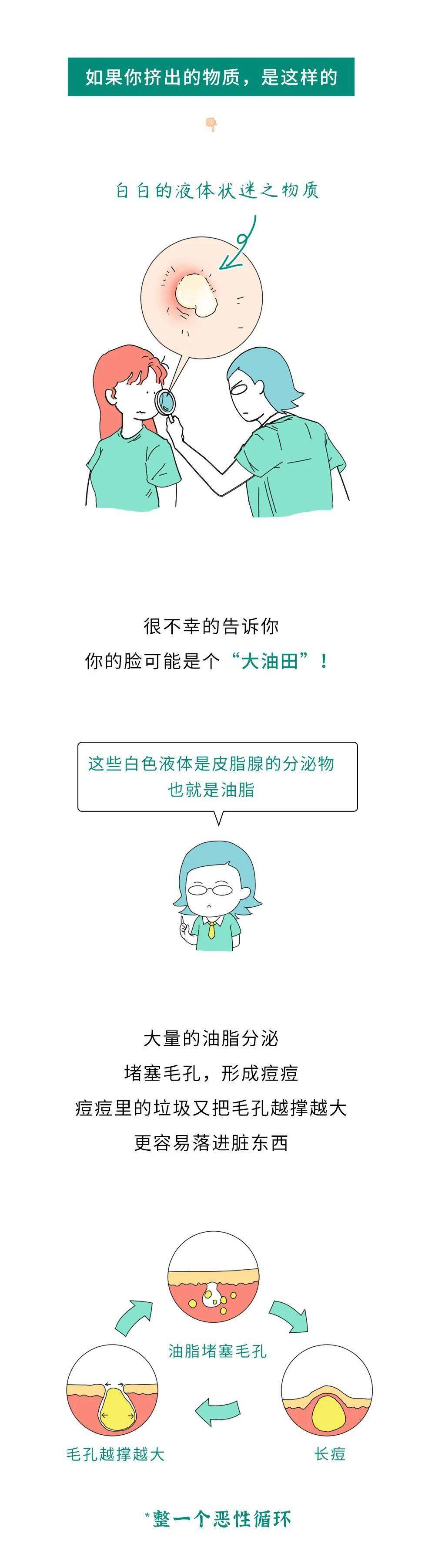 挤痘痘挤出的"白浆"到底是啥啊?