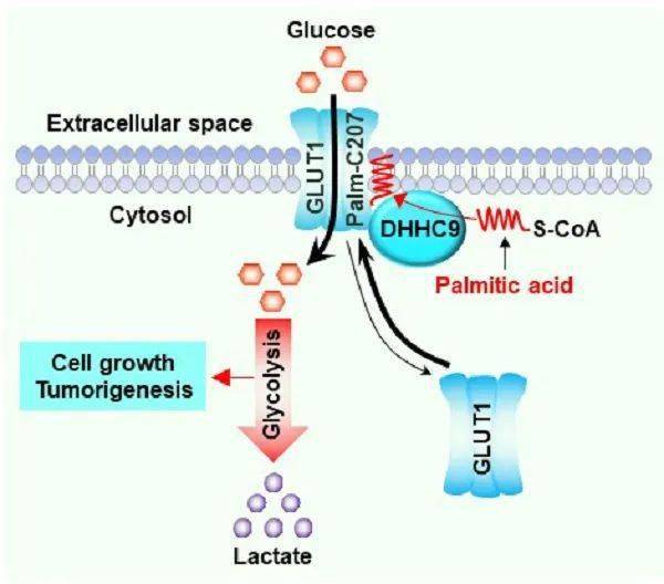 李新建研究团队研究揭示葡萄糖转运蛋白glut1促进胶质瘤糖酵解和恶性