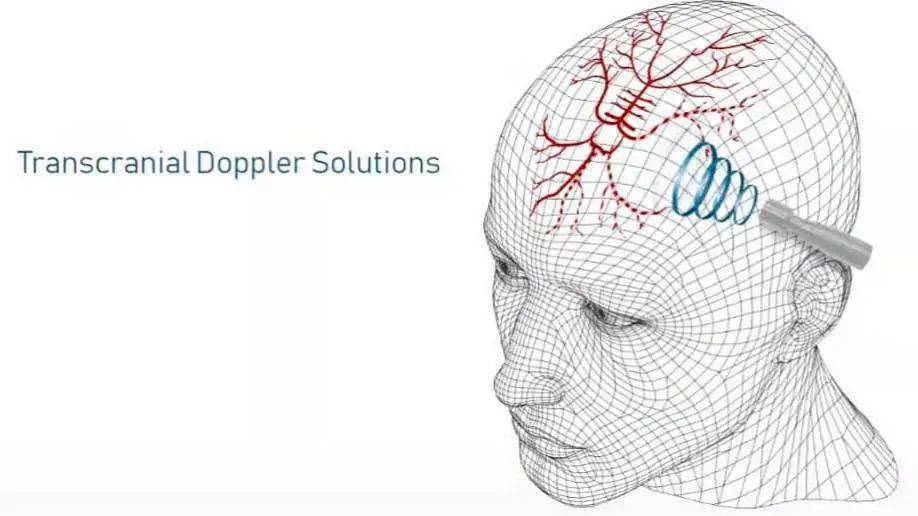 tccd给大脑做个彩超
