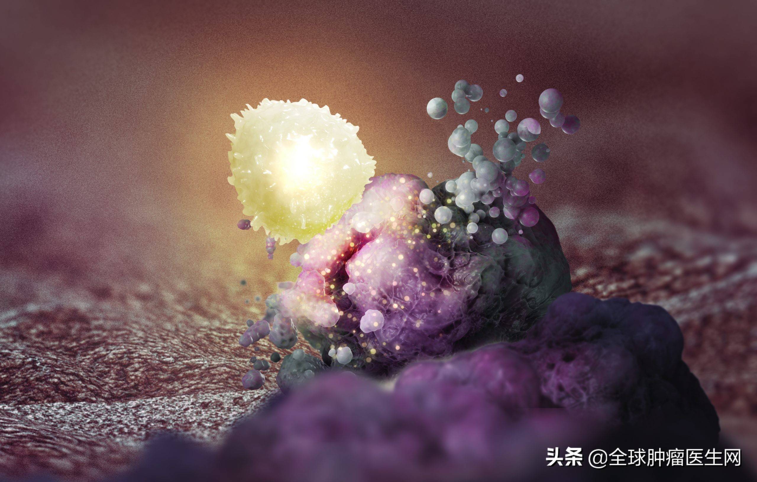 如何将杀癌能力最强的这部分til免疫细胞扩大