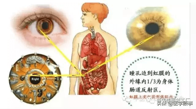 先天肠道狭窄与便秘结肠色素斑肠道憩室结肠憩室可引起淋巴滤泡增生