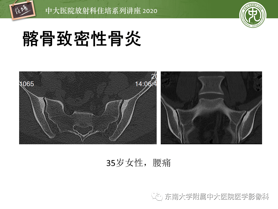 常见骶髂关节病变的影像表现_平台_版权_声明