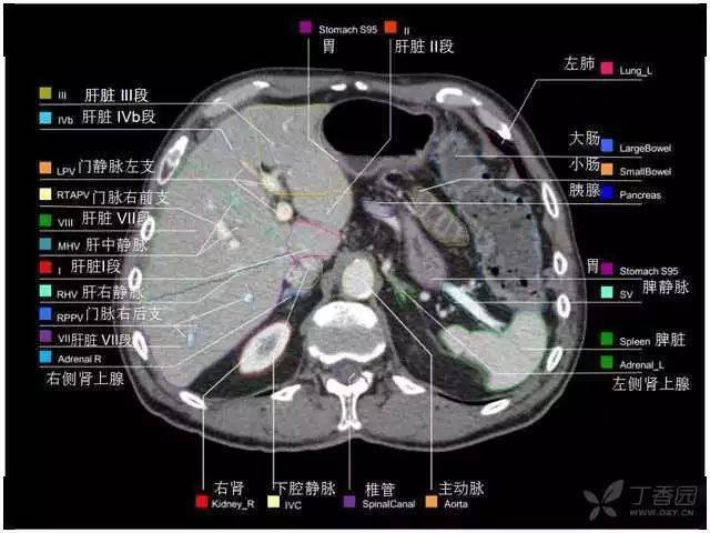 收藏史上最全的ct断层解剖图谱