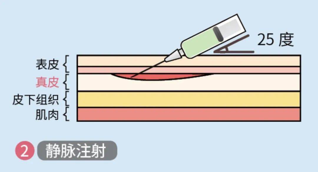 让打针几乎没有痛感儿童可以实现无针注射啦这背后隐藏着什么黑科技