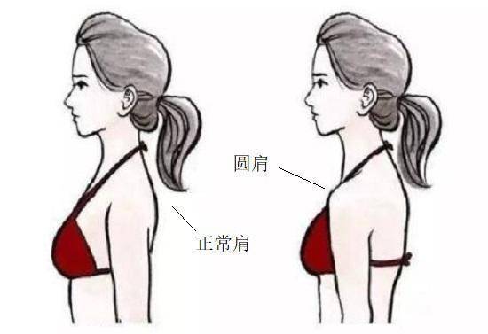 的情况下,如果胸小肌和肱二头肌长时间紧张或紧缩,就会使肩胛骨前伸