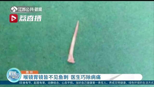 喉镜胃镜皆不见鱼刺医生实施全麻手术进行地毯式排查