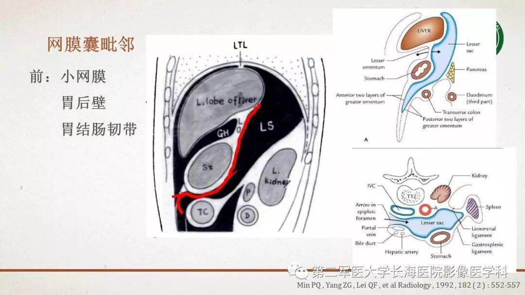 包罗万象的腹膜结构我们真的了解吗影像解剖