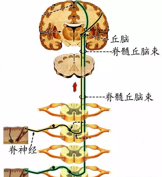 元:脊髓灰质后角(交叉后上行,形成脊髓丘脑束(脊髓丘脑侧束传导痛温觉