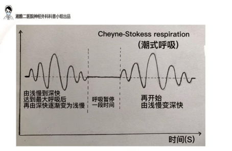 除此之外,呼吸兴奋剂如氨茶碱可使潮式呼吸患者恢复正常呼吸节律.