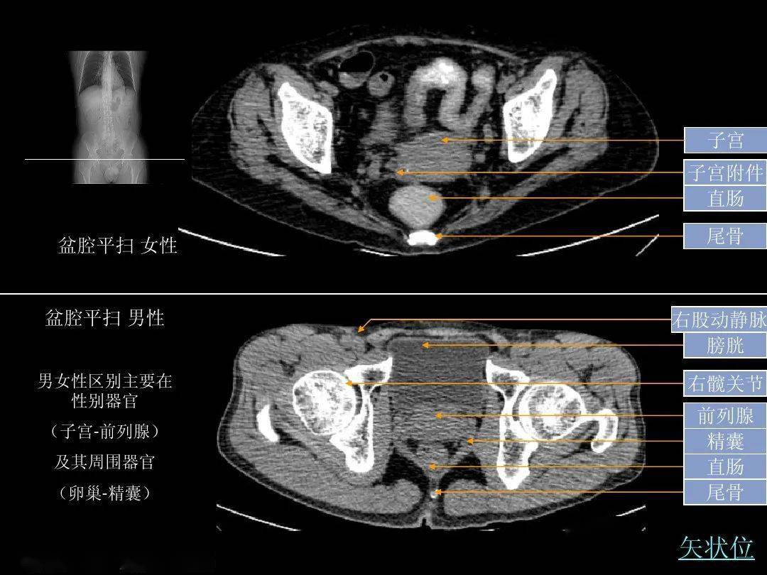 超细的腹部ct入门精美解剖图谱_图像_血管_器官