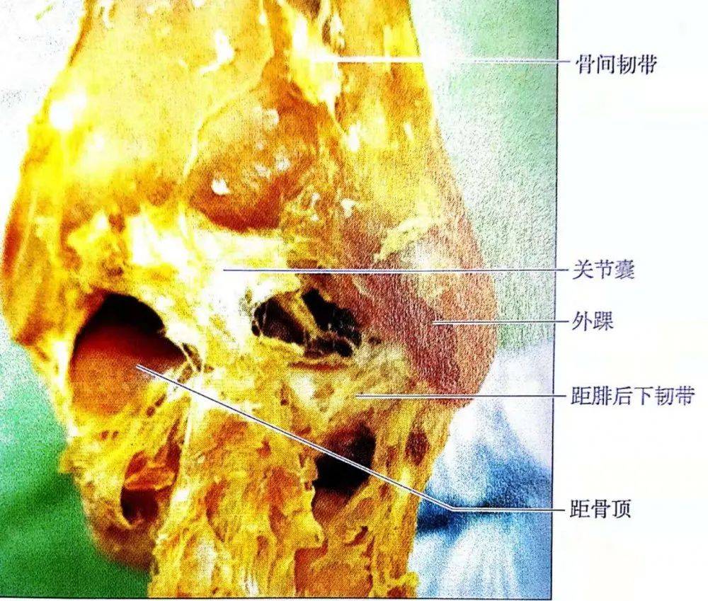 踝关节骨折的手术治疗技巧与预后处理_韧带_胫骨_检查