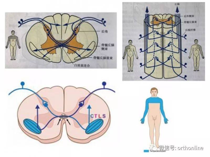 一文读懂脊髓的解剖和定位诊断_病变_感觉_丘脑