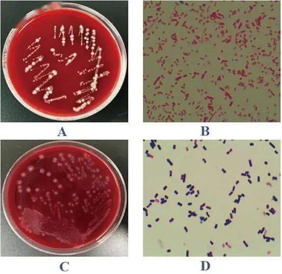 培养基上有大量密集的白色呈中等大小的菌落,镜检为革兰氏阴性杆菌