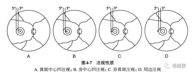 如果中心凹在该标志上轻微移动但不出标志范围,则为不稳定中心注视②