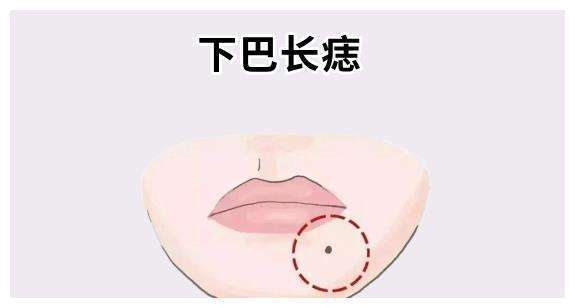 痣相看下巴长痣的位置与吉凶分别代表什么含义?你知道吗?